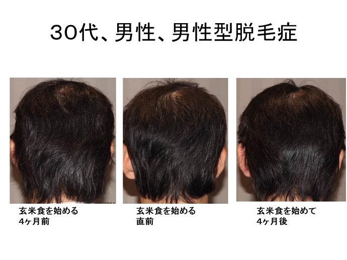 玄米の効果