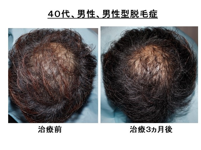 患者様の声；"継続は、力ですね!" |患者様からの声 ...