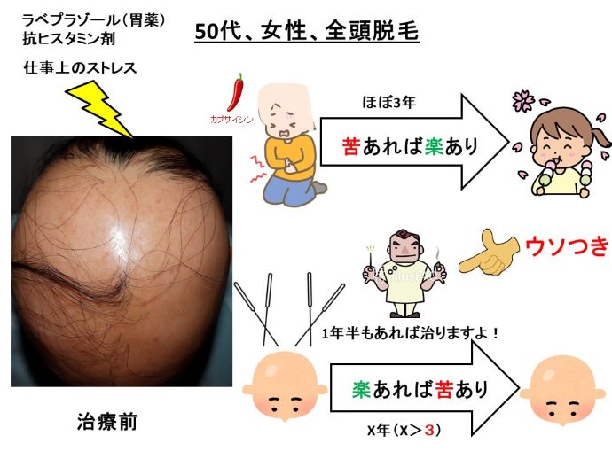 円形脱毛症 名医 円形脱毛症 病院