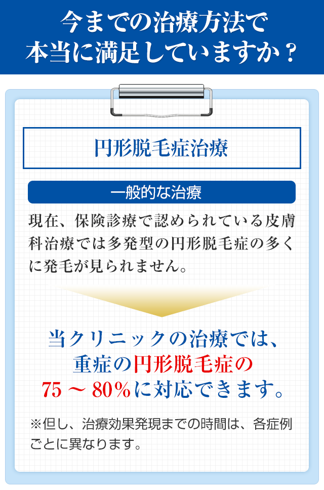 今までの治療方法で本当に満足していますか？円形脱毛症治療